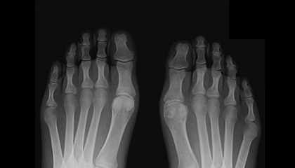 Medical issues and orthotics